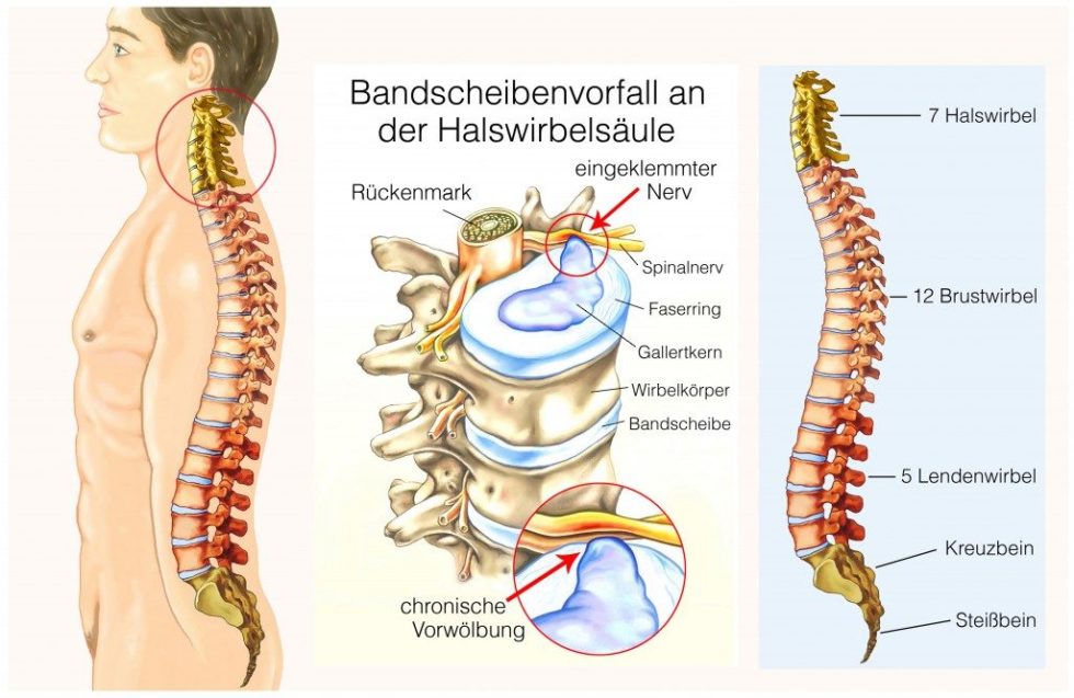 Hws Schwindel Im Liegen